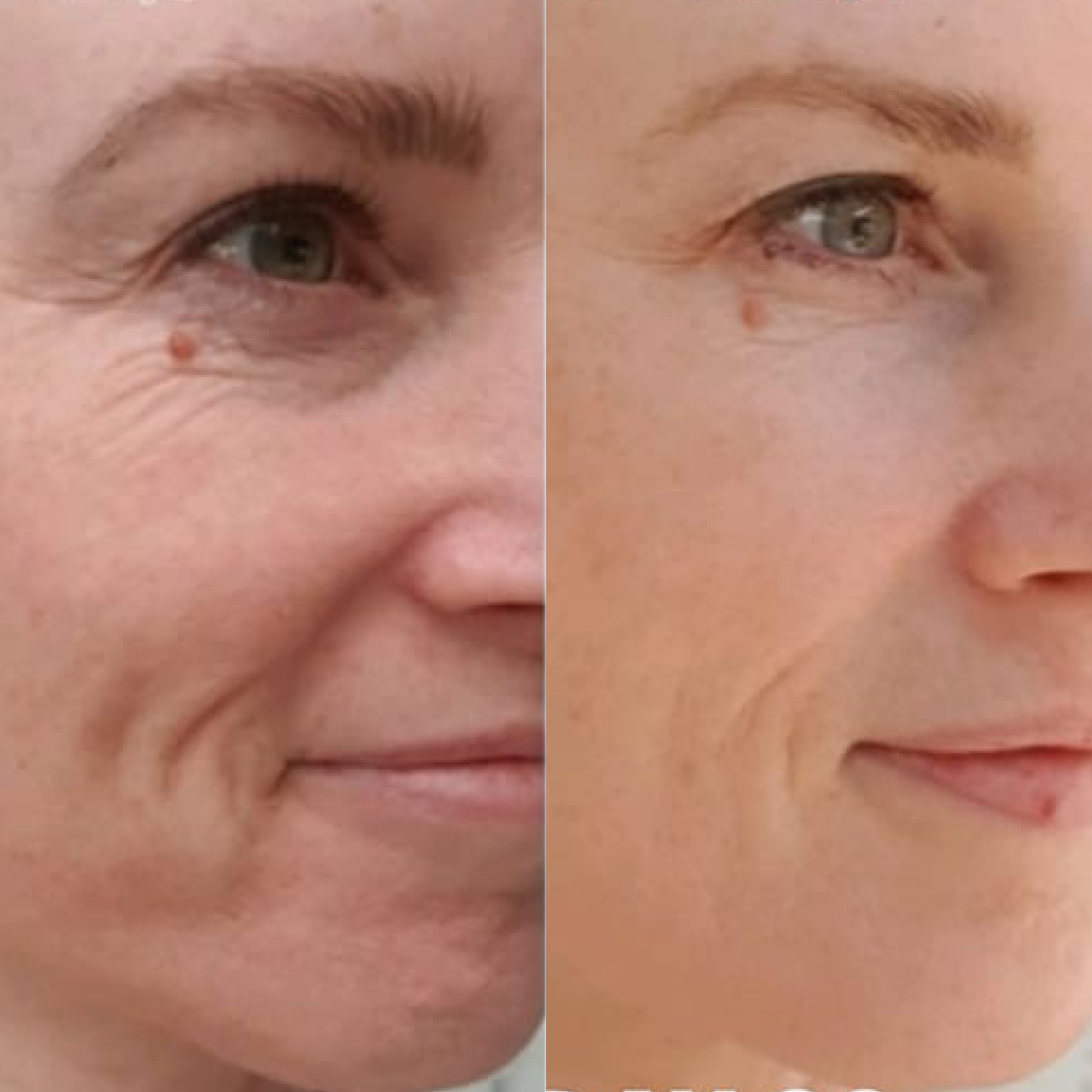 ANZ_sarah kavanagh collagen